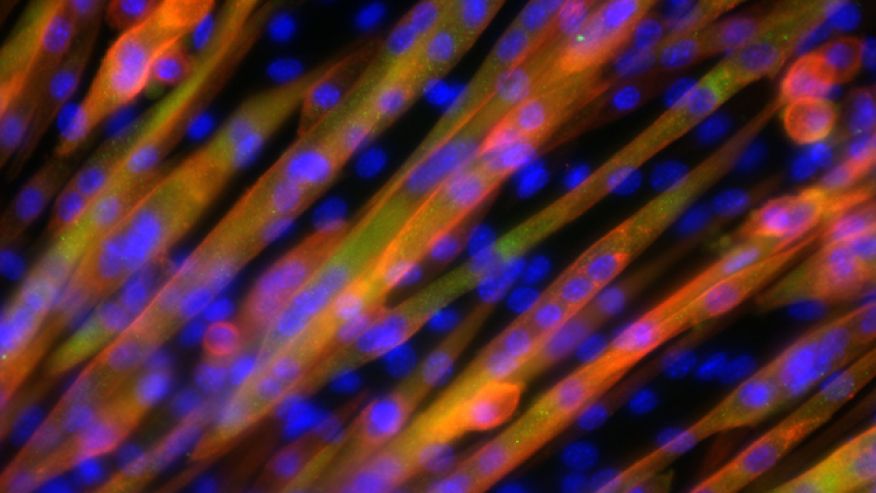 Scientists grow contracting human muscle tissue